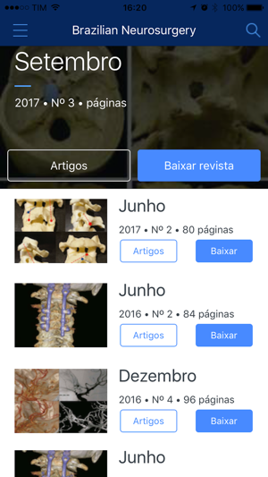 Brazilian Neurosurgery(圖2)-速報App