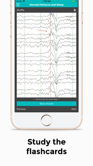 EEG(圖3)-速報App