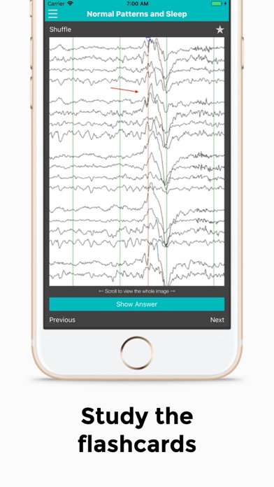 How to cancel & delete EEG from iphone & ipad 3