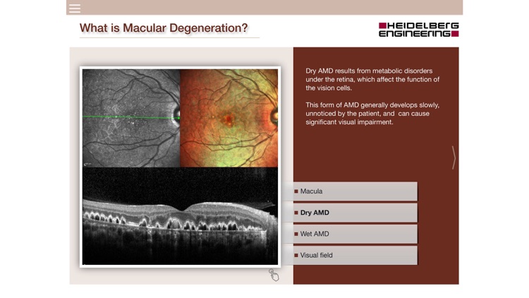 Ophthalmic Practice App