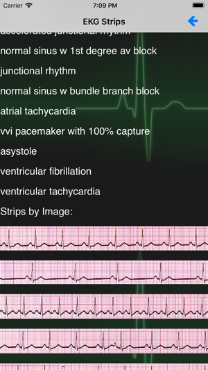 EKG Academy(圖2)-速報App