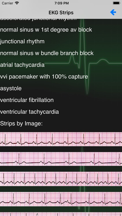 EKG Academy