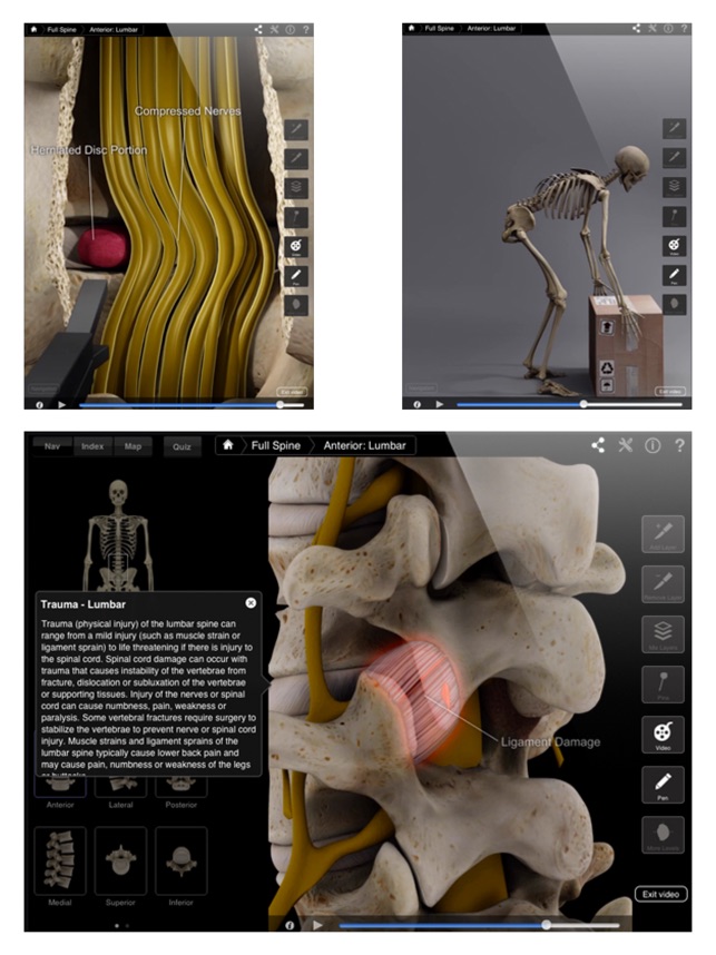 Spine Pro III(圖2)-速報App