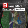 Ryo Matsuda - Brain MRI Sectional Walker アートワーク