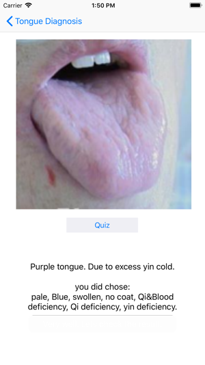 Tongue Diagnosis(圖5)-速報App