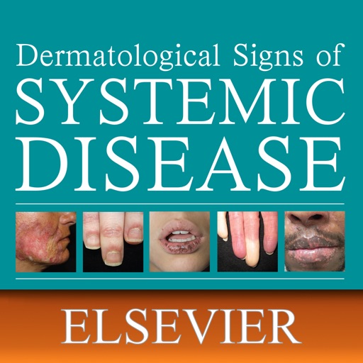 Derm Signs of Systemic Disease