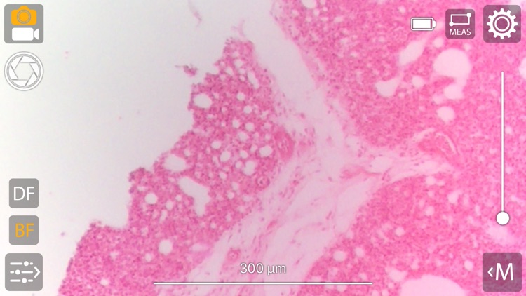 microPeek screenshot-4