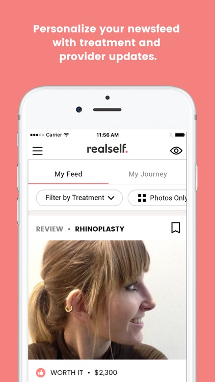 RealSelf: Treatments & Reviews