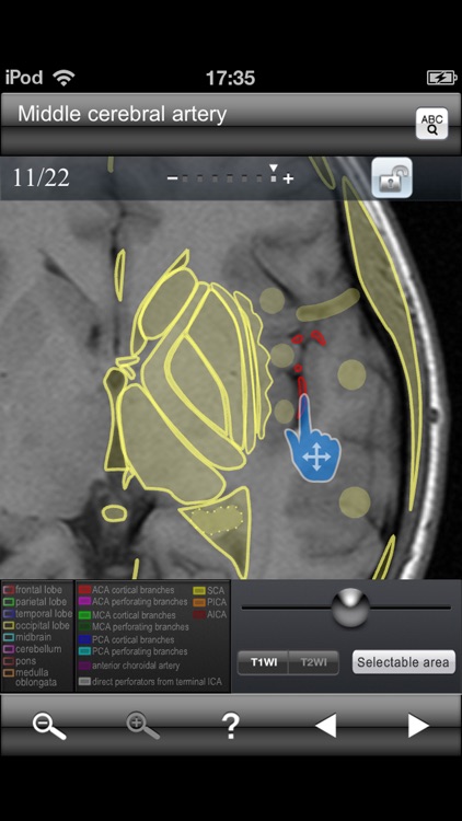 Brain MRI Sectional Walker screenshot-4