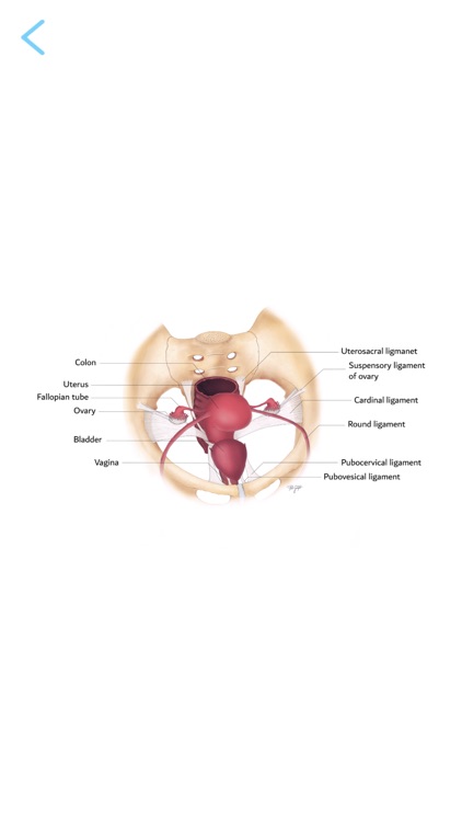 Female pelvis MRI RSNA