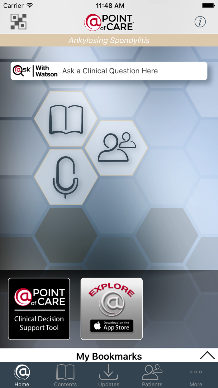 Ankylosing Spondylitis PoC