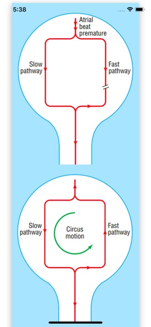 ECG Basics Lite: ECG Made Easy(圖3)-速報App