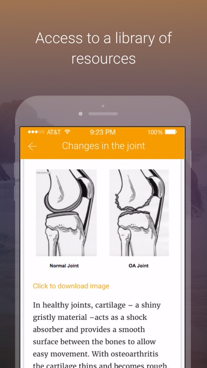 MOA Managing Osteoarthritis