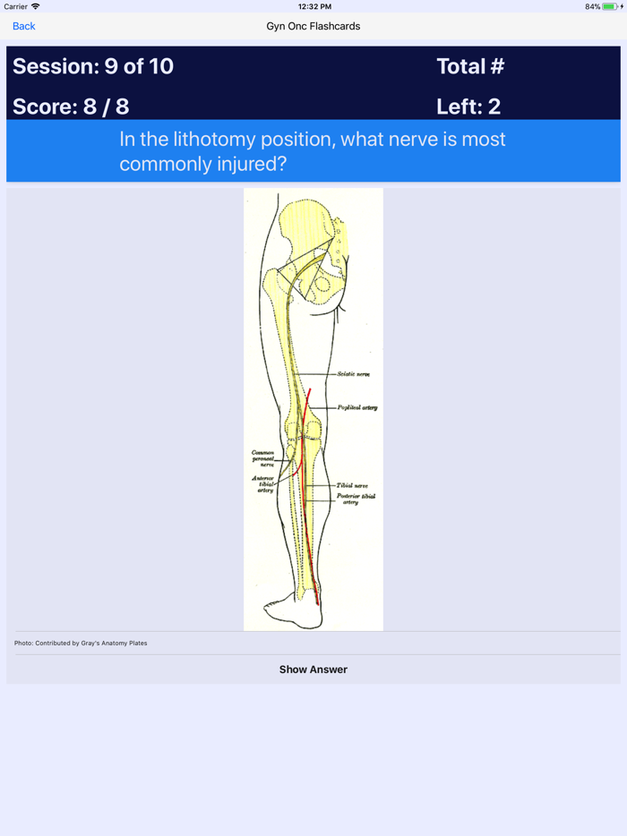 GYN ONC Board Review