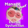 Manage your Erectile Dysfunction 4