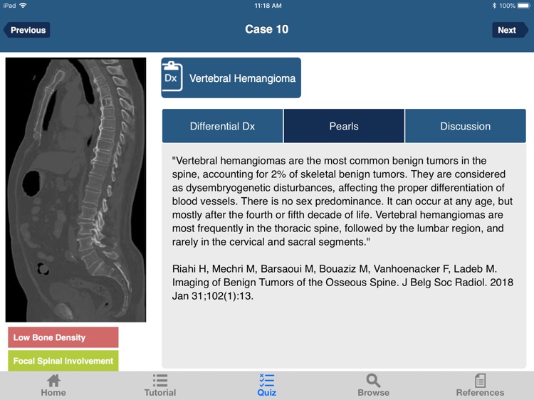 CTisus L-Spine Pathology screenshot-5