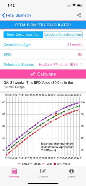 Fetal Ultrasound(圖4)-速報App