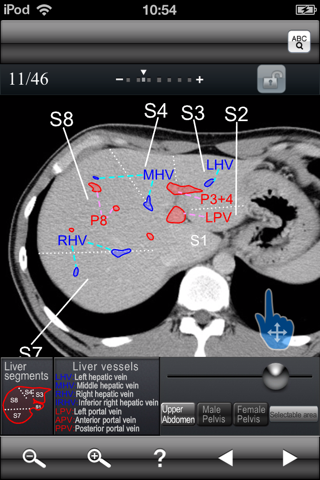 Abdominal CT Sectional Walker screenshot 2