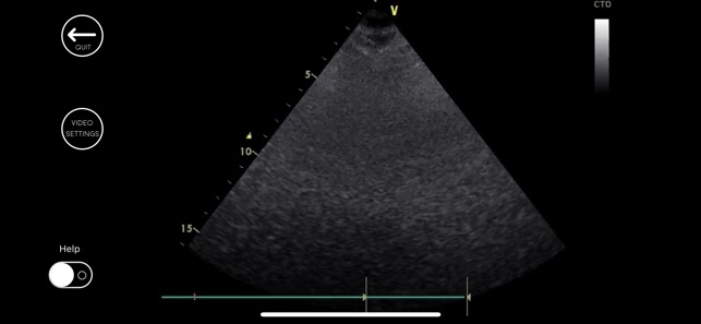 Awesome Ultrasound Simulator(圖3)-速報App