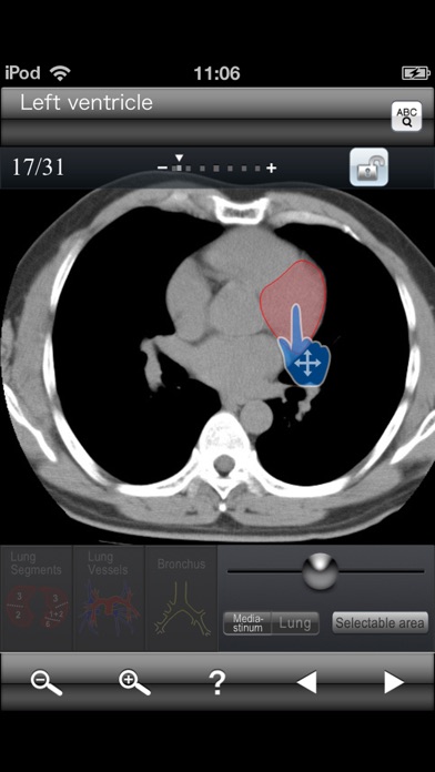 Chest CT Sectional Wa... screenshot1