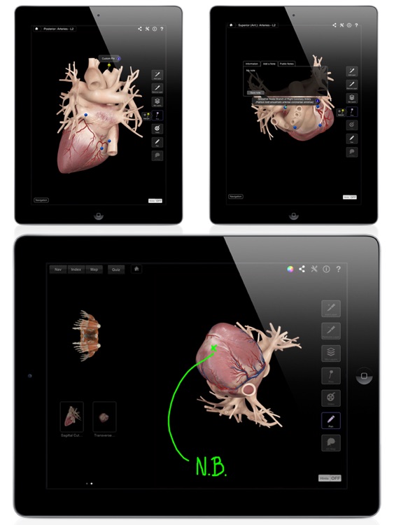 Heart Pro III screenshot-3