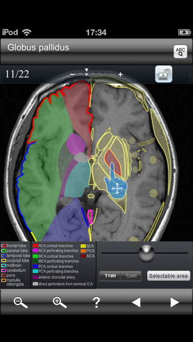 Brain MRI Sectional Walker Screenshot 1