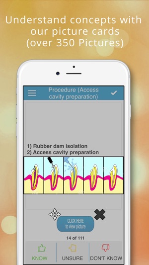 NBDE Dental Board- Endodontics(圖2)-速報App