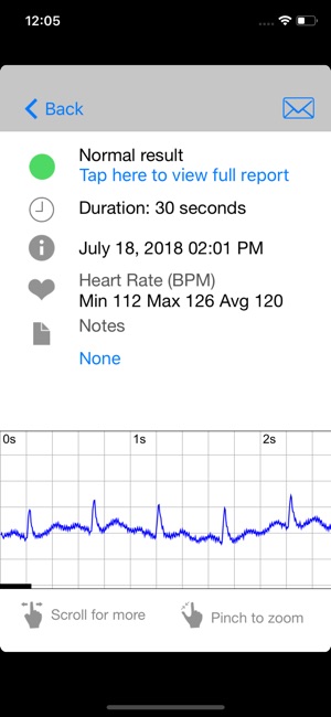 Peerbridge ECG Check(圖2)-速報App