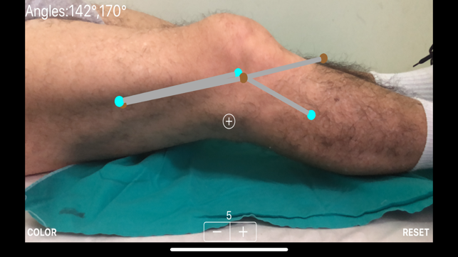 ARorthopaedicGoniometer(圖5)-速報App