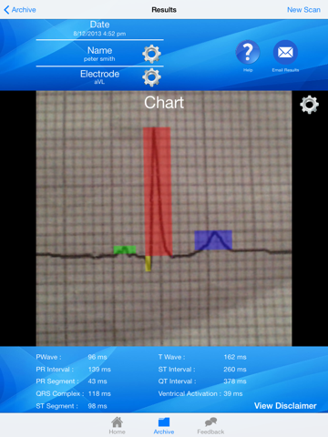 Doctor ECG guide & calculator - náhled