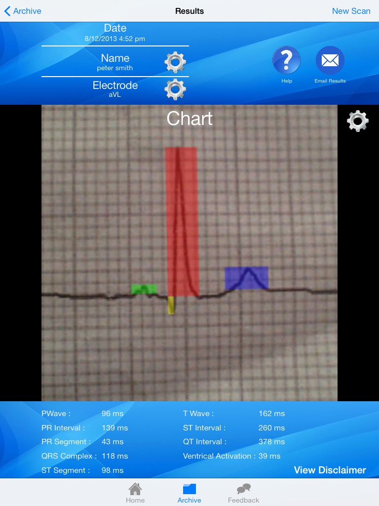 Doctor ECG guide & calculator screenshot 3