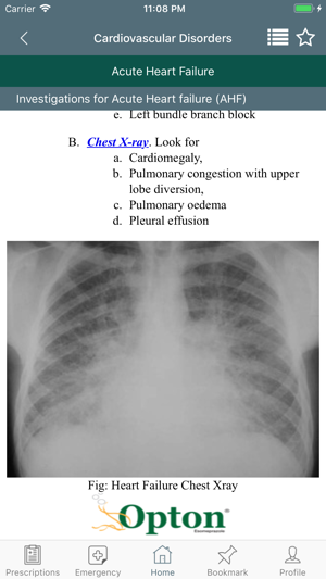 PDM - ITmedicus(圖7)-速報App