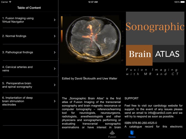 Sonographic Brain Atlas