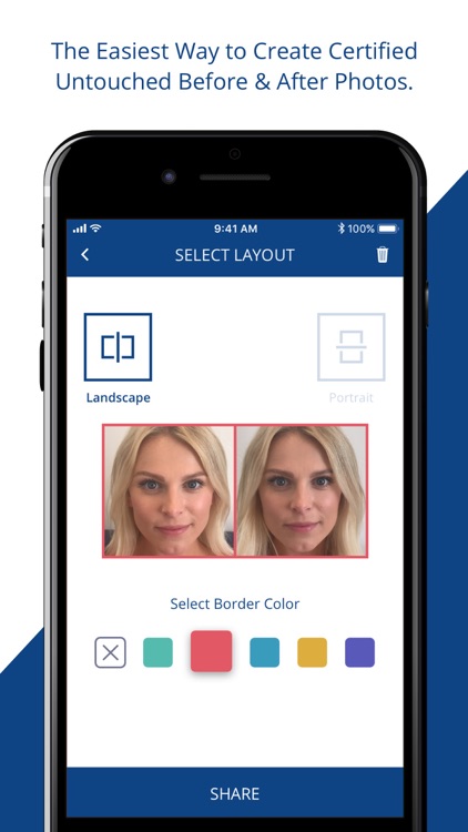 Before & After by TRUEPIC by TRUEPIC Inc