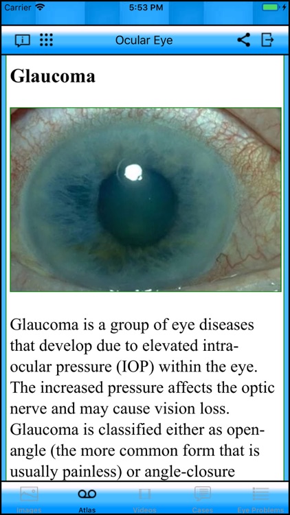 Ocular Eye screenshot-4