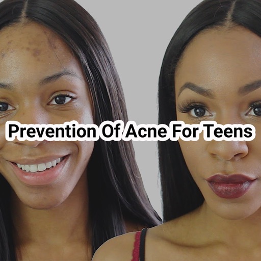 Prevention of Acne Forteens icon