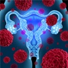Gynecology:Nutrition and Prevention