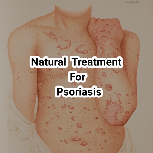 Natural treatments for psoriasis and psoriatic arthritis icon