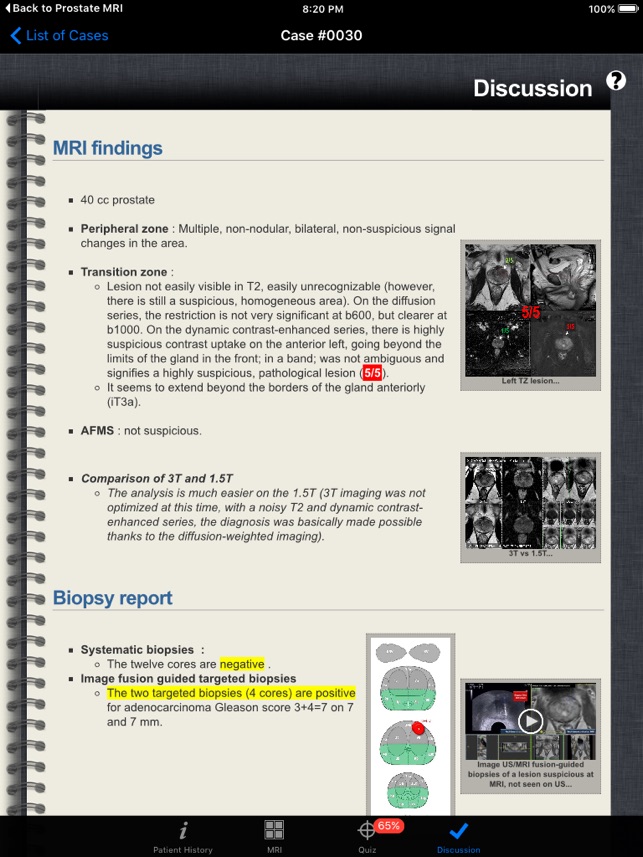 Prostate Cancer Imaging(圖5)-速報App