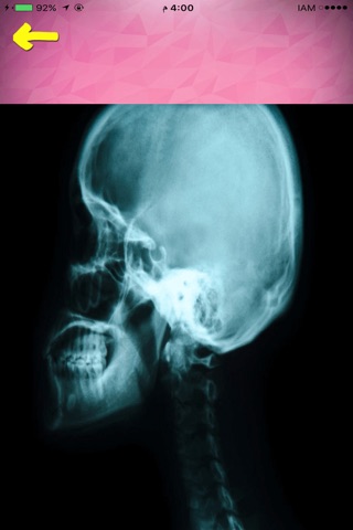 X-Ray Body Bones Scanner screenshot 4