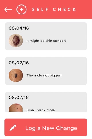 SelfCheck - Skin Cancer Prevention screenshot 4