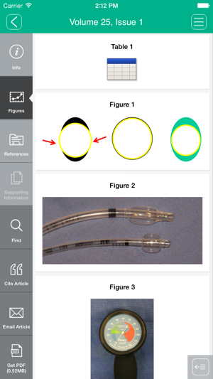 Pediatric Anesthesia(圖2)-速報App