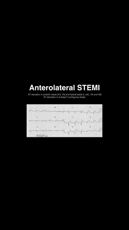 Complete PANCE/PANRE Review Course (Video Lecture and Questions)