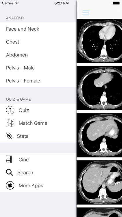iAnatomy