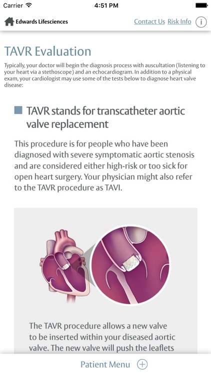 Edwards TAVR Companion screenshot-4