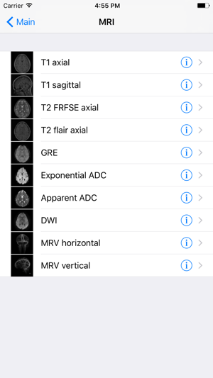 Brain Images(圖3)-速報App