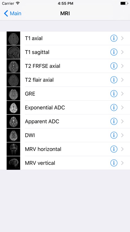 Brain Images