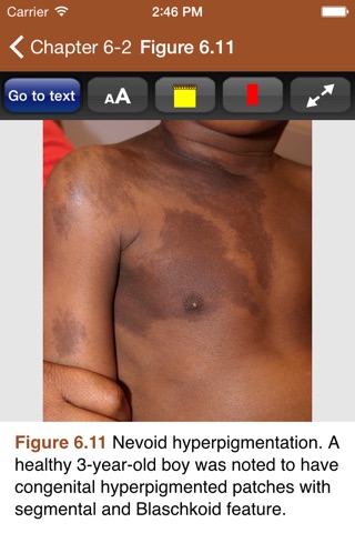 Cohen Pediatric Dermatology 4E screenshot 4