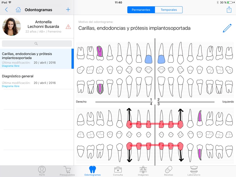 Zumo Odontología