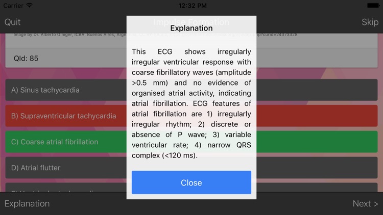 ECG Master - Quiz, Exam, Explanation, Statistic screenshot-3